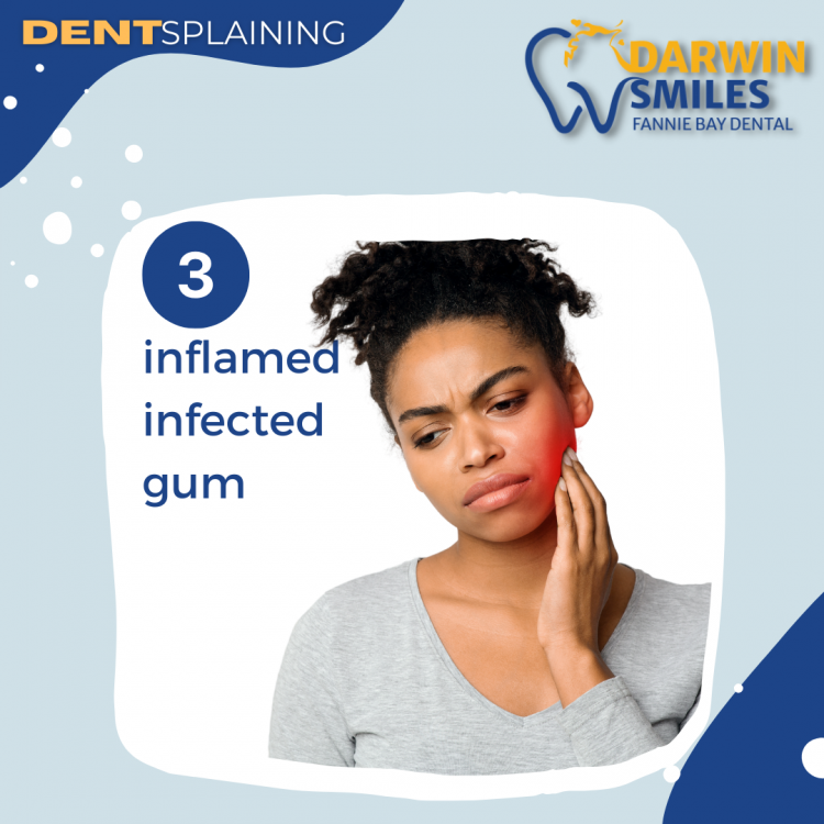 infected gum wisdom tooth
