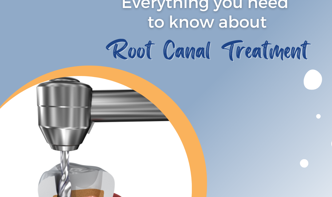 root canal treatment darwin