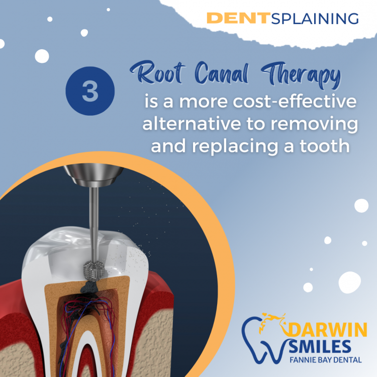root canal therapy darwin dentist